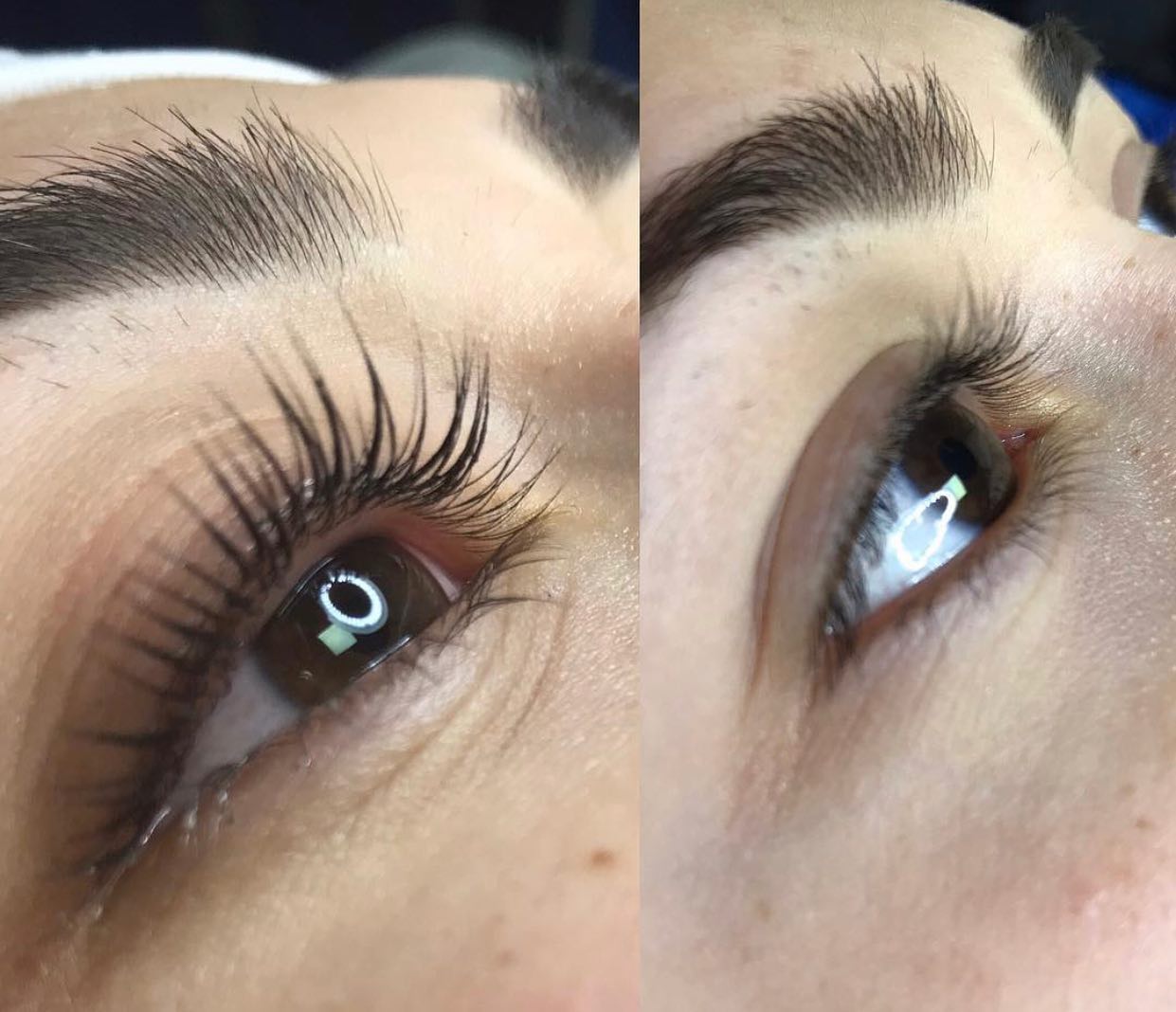 Bella Beauty Kirpik Lifting Öncesi Sonrası