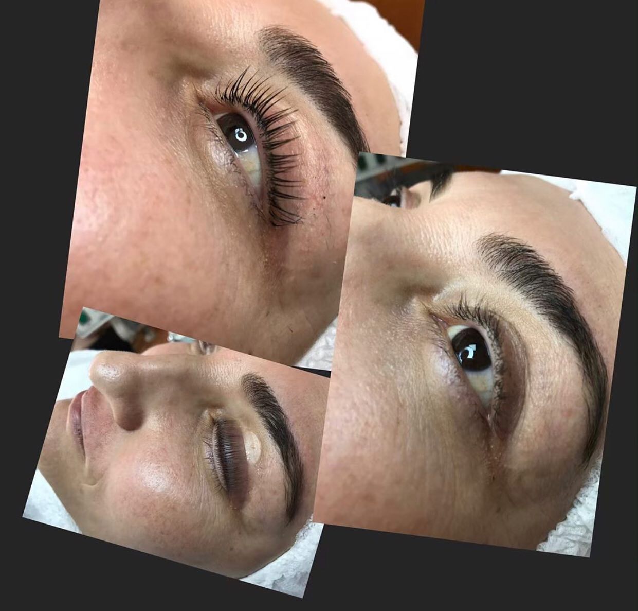 Doğal ve Kıvrık Kirpik Lifting Sonucu